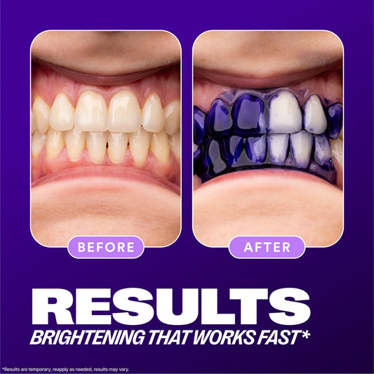 Hismile Teeth Whitening V34 Colour Corrector Serum – Purple Toothpaste for Brighter Smile