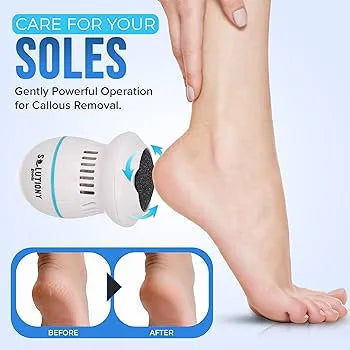 Rechargeable Foot Pedicure Grinder – Callus Remover & Dead Skin Polisher - MonoTronix