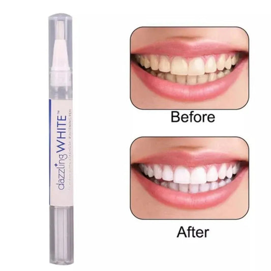 Dazzling White Instant Teeth Whitening Pen – Professional Fast-Acting Formula - MonoTronix